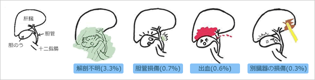 ���o�����_�̂��E�o�p�̏p���n�v�j���O�ƕp�x�̑S�����v